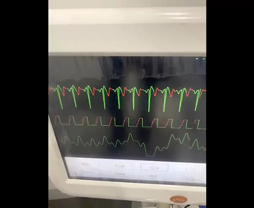 Cardiac Treatment Cardiac Treatment