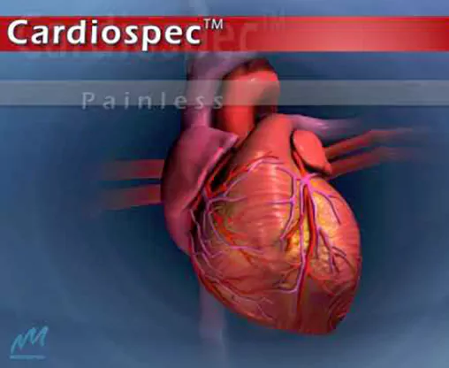 Cardiospec Non-Invasive Cardiac Angiogenesis Therapy Cardiospec Non-Invasive Cardiac Angiogenesis Therapy